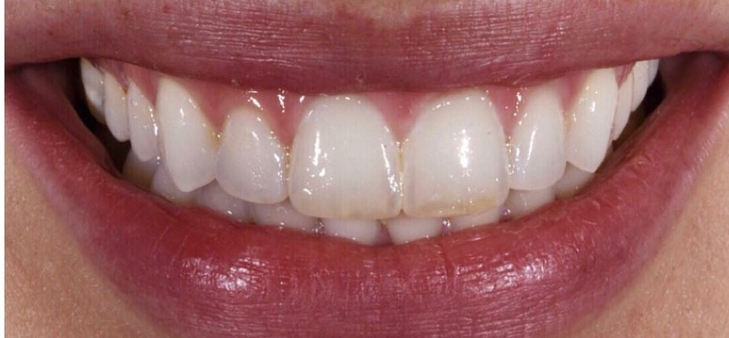 Aspen Dental Care